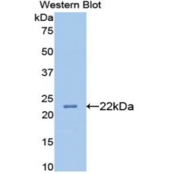 Apolipoprotein B-100 (APOB) Antibody