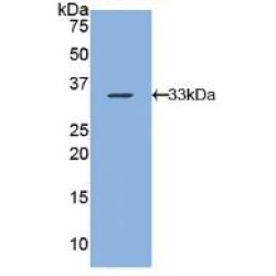 Arrestin Beta 1 (ARRb1) Antibody