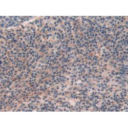 Arrestin Beta 1 (ARRb1) Antibody