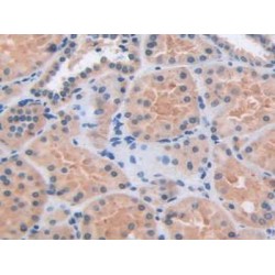 Arrestin Beta 1 (ARRb1) Antibody