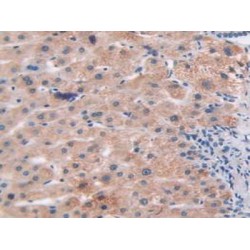 Arrestin Beta 1 (ARRb1) Antibody