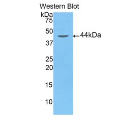 Arrestin Beta 2 (ARRb2) Antibody