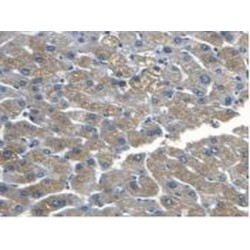 Catenin Beta 1 (CTNNb1) Antibody