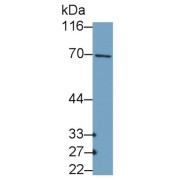 WB analysis of MCF7 cell lysates, using Collagen Type X Alpha 1 (COL10A1) Antibody (0.4 µg/ml) and HRP-conjugated Goat Anti-Rabbit antibody (<a href="https://www.abbexa.com/index.php?route=product/search&amp;search=abx400043" target="_blank">abx400043</a>, 0.2 µg/ml).