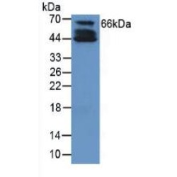 Collagen Type X Alpha 1 (COL10A1) Antibody
