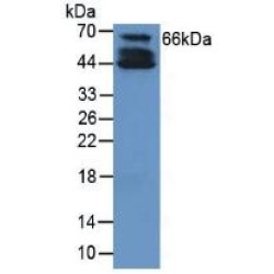 Collagen Type X Alpha 1 (COL10A1) Antibody