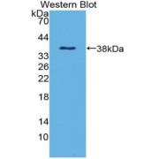 WB analysis of recombinant Beta-Defensin 1 (DEFB1) protein using Beta-Defensin 1 (DEFB1) antibody.