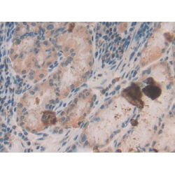 Beta-Defensin 1 (DEFB1) Antibody