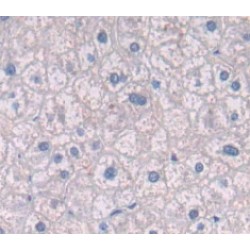 Integrin Beta 4 (ITGb4) Antibody