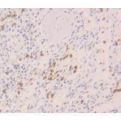 Interferon Alpha-1 (IFNA1) Antibody
