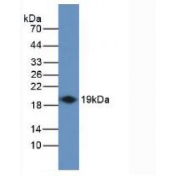 Interferon Gamma (IFNg) Antibody