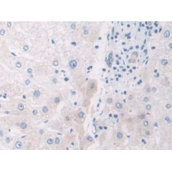 Interleukin 12A (IL12A) Antibody