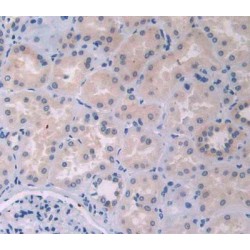 Interleukin 12A (IL12A) Antibody
