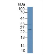 Western blot analysis of Mouse Pancreas lysate, using Human IL17B Antibody (2 µg/ml) and HRP-conjugated Goat Anti-Rabbit antibody (<a href="https://www.abbexa.com/index.php?route=product/search&amp;search=abx400043" target="_blank">abx400043</a>, 0.2 µg/ml).