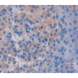 Interleukin 17B (IL17B) Antibody