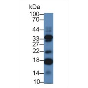 abx101514