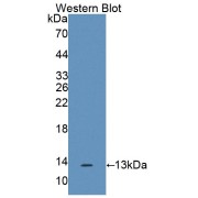 abx101516