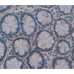Interleukin 17F (IL17F) Antibody