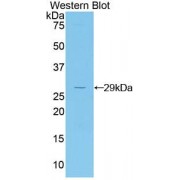 Western blot analysis of recombinant Mouse JAG2 protein.
