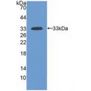 Western blot analysis of recombinant Human LAMa3.