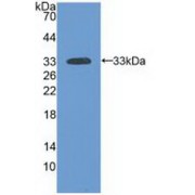 Western blot analysis of recombinant Human LAMa3.
