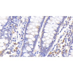 Metallothionein 1 (MT1) Antibody