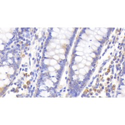 Metallothionein 1 (MT1) Antibody