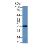 Western blot analysis of Rat Brain lysate, using Rat PRDX2 Antibody (2 µg/ml) and HRP-conjugated Goat Anti-Rabbit antibody (<a href="https://www.abbexa.com/index.php?route=product/search&amp;search=abx400043" target="_blank">abx400043</a>, 0.2 µg/ml).