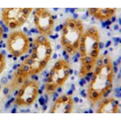 Peroxiredoxin 5 (PRDX5) Antibody