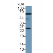Western blot analysis of Rat Testis lysate, using Human PRDX6 Antibody (2 µg/ml) and HRP-conjugated Goat Anti-Rabbit antibody (<a href="https://www.abbexa.com/index.php?route=product/search&amp;search=abx400043" target="_blank">abx400043</a>, 0.2 µg/ml).
