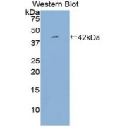 Western blot analysis of recombinant Rat PF4 Protein (containing N-terminal His and GST tags).