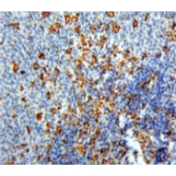 Platelet Factor 4 (PF4) Antibody