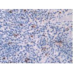 Platelet Factor 4 (PF4) Antibody