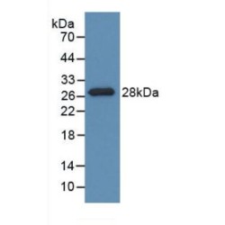 Pyridoxal Kinase (PDXK) Antibody
