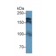 Western blot analysis of Human Serum, using Human TOP2 Antibody (1 µg/ml) and HRP-conjugated Goat Anti-Rabbit antibody (<a href="https://www.abbexa.com/index.php?route=product/search&amp;search=abx400043" target="_blank">abx400043</a>, 0.2 µg/ml).