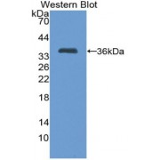 Western blot analysis of recombinant Human TFF1.