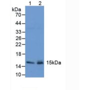Western blot analysis of (1) Mouse Stomach Tissue and (2) Mouse Pancreas Tissue.