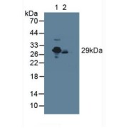 Western blot analysis of (1) Rat Serum and (2) Mouse Serum.