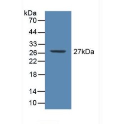 C Reactive Protein (CRP) Antibody