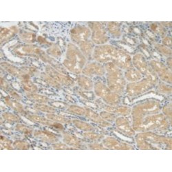 C Reactive Protein (CRP) Antibody