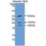 Western blot analysis of the recombinant protein.