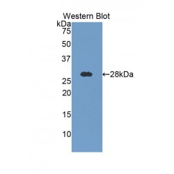 Beta-Galactosidase (GLB1) Antibody