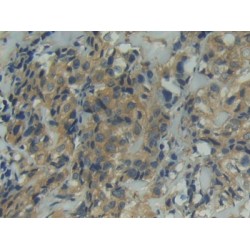 Integrin Alpha D / CD11D (ITGAD) Antibody
