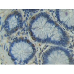 Integrin Alpha D / CD11D (ITGAD) Antibody