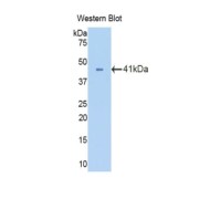 Western blot analysis of the recombinant protein.