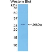 abx101654