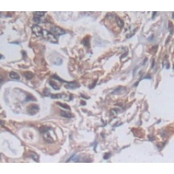 Protein Kinase N2 (PKN2) Antibody