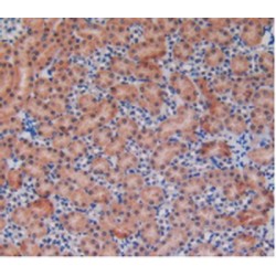 Eosinophil Cationic Protein / ECP (RNASE3) Antibody