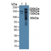 Western blot analysis of (1) Mouse Serum and (2) Mouse Heart Tissue.