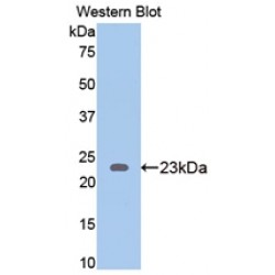 Thrombospondin 1 (THBS1) Antibody